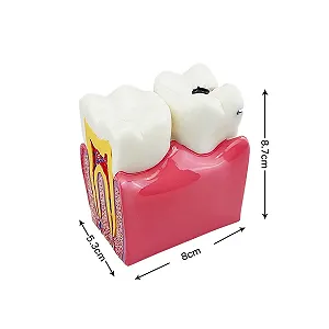 Model dentar al dintilor